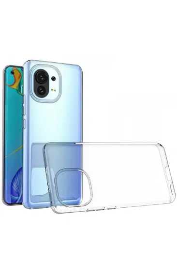 Newface Xiaomi Mi 11 Kılıf Lüx Şeffaf Silikon resmi
