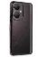 Newface Vivo Y27 Kılıf Razer Lensli Silikon - Siyah resmi