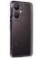 Newface Vivo Y27 Kılıf Razer Lensli Silikon - Mor resmi