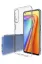 Newface Realme 7 Pro Kılıf Lüx Şeffaf Silikon - Şeffaf resmi