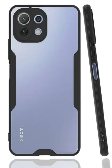 Newface Xiaomi Mİ 11 Lite Kılıf Platin Silikon - Siyah resmi