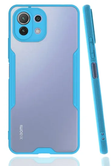 Newface Xiaomi Mİ 11 Lite Kılıf Platin Silikon - Mavi resmi