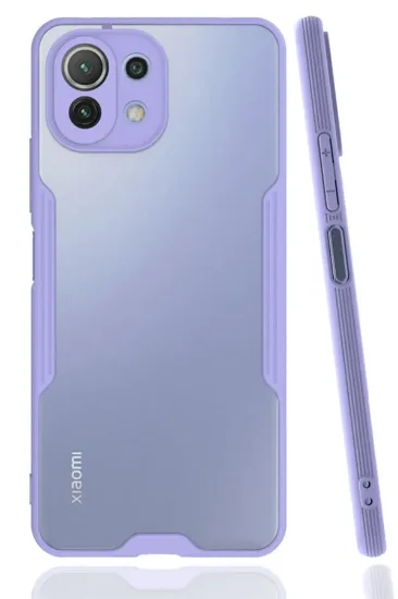 Newface Xiaomi Mİ 11 Lite Kılıf Platin Silikon - Lila resmi