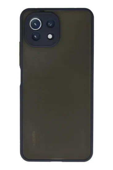 Newface Xiaomi Mİ 11 Lite Kılıf Montreal Silikon Kapak - Lacivert resmi