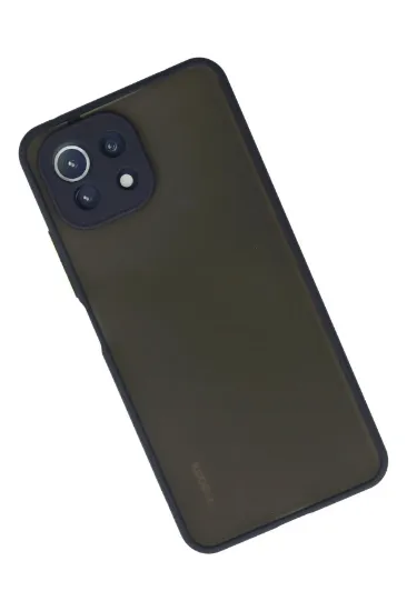 Newface Xiaomi Mİ 11 Lite Kılıf Montreal Silikon Kapak - Lacivert resmi
