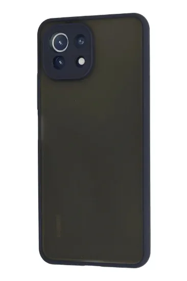 Newface Xiaomi Mİ 11 Lite Kılıf Montreal Silikon Kapak - Lacivert resmi