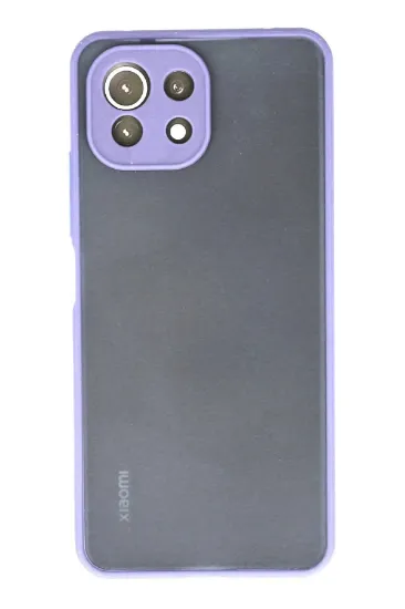 Newface Xiaomi Mİ 11 Lite Kılıf Montreal Silikon Kapak - Mor resmi