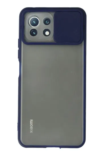 Newface Xiaomi Mİ 11 Lite Kılıf Palm Buzlu Kamera Sürgülü Silikon - Lacivert resmi