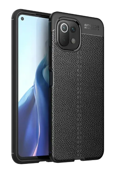 Newface Xiaomi Mİ 11 Lite Kılıf Auto Focus Kapak - Siyah resmi