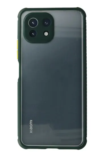 Newface Xiaomi Mİ 11 Lite Kılıf Miami Şeffaf Silikon - Koyu Yeşil resmi