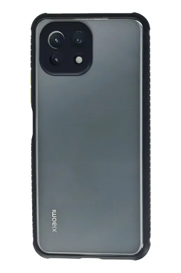 Newface Xiaomi Mİ 11 Lite Kılıf Miami Şeffaf Silikon - Lacivert resmi