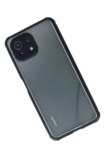 Newface Xiaomi Mİ 11 Lite Kılıf Miami Şeffaf Silikon - Lacivert resmi